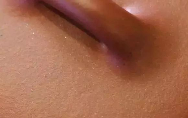 云母